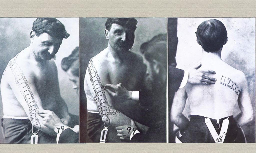 Nerve Tracing and the Morikubo Trial: A Pivotal Moment in Chiropractic History